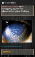 Ophthalmology