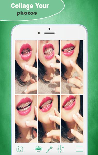 Braces Booth Pro