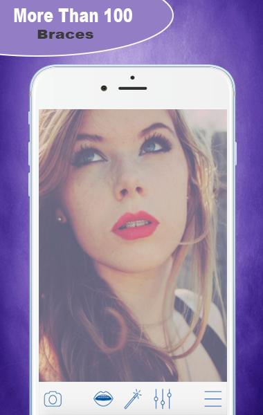 Braces Booth Pro