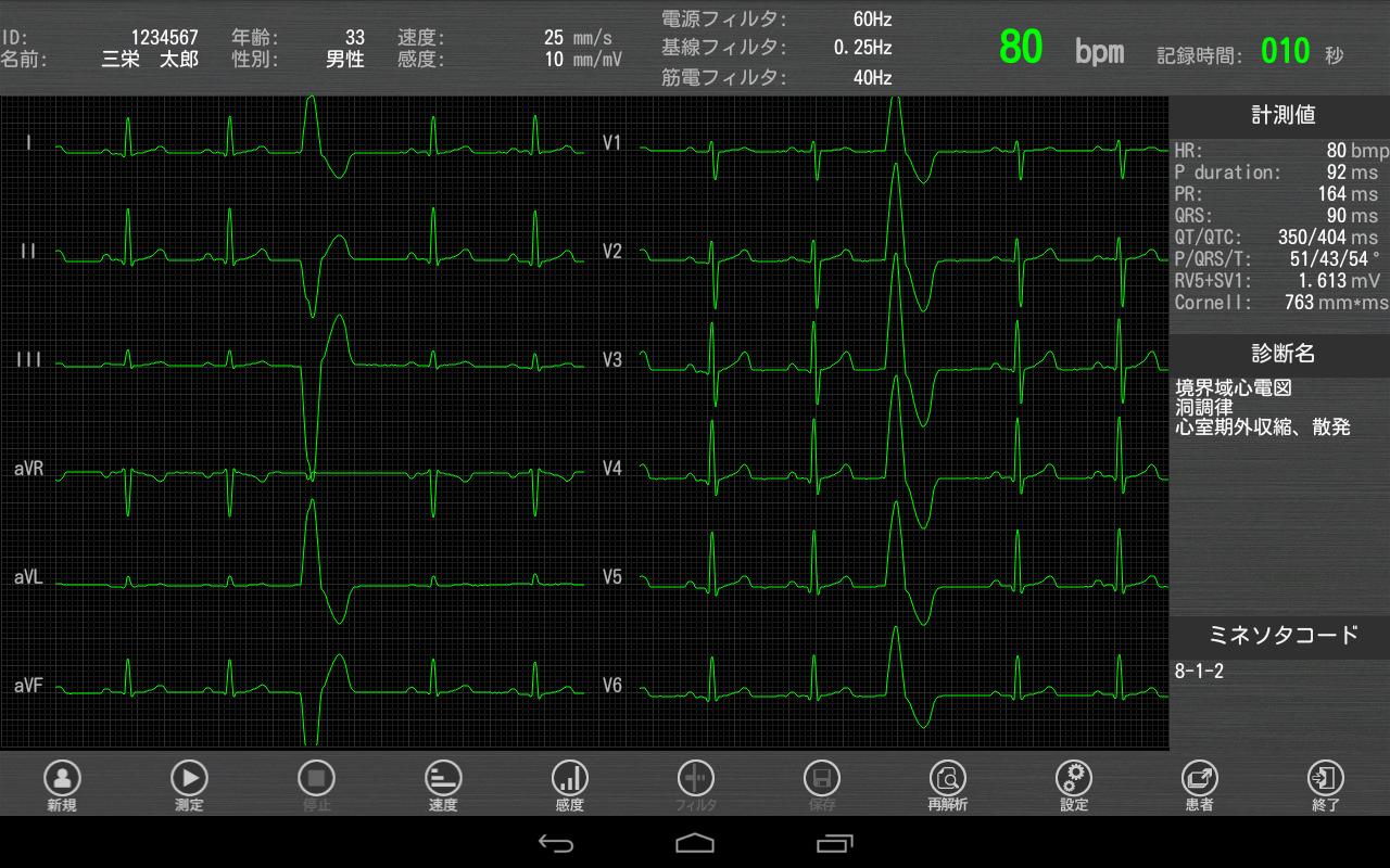 Tablet ECG